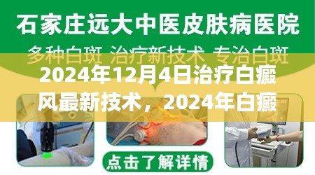 2024年白癜风治疗最新技术解读与应用前景展望,革新与未来趋势